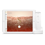 API-100 Skin Check Pro - immagine 4